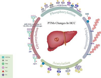 Potential Biomarkers for Liver Cancer Diagnosis Based on Multi-Omics Strategy